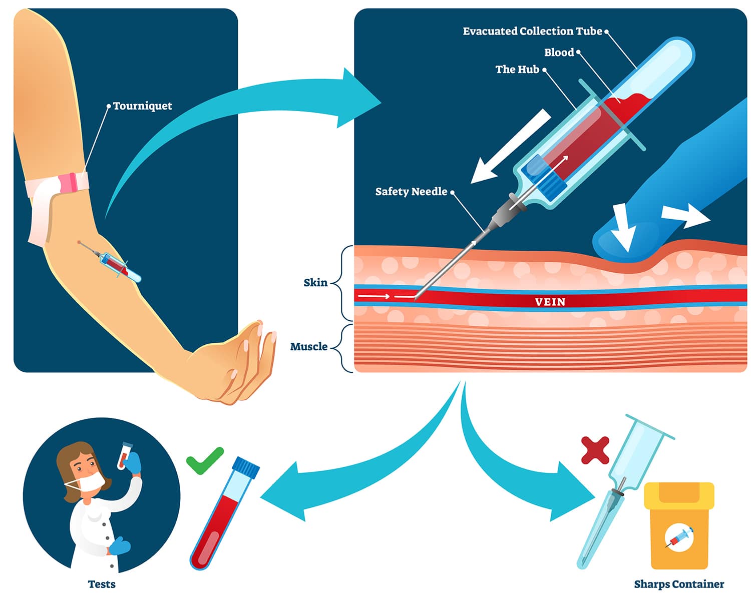 Phlebotomy Training Infographic
